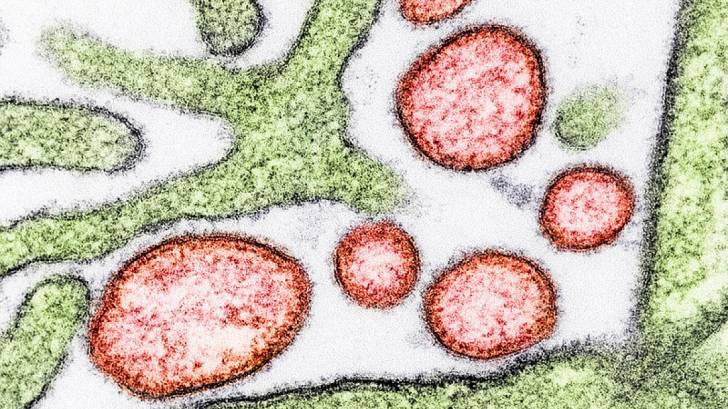 nipah virus under the microscope