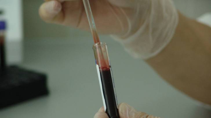 technician doing a blood test with stem cells