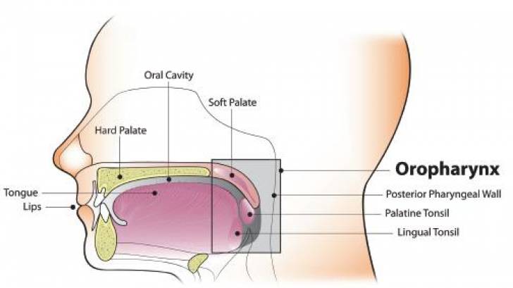 throat cancer vaccine