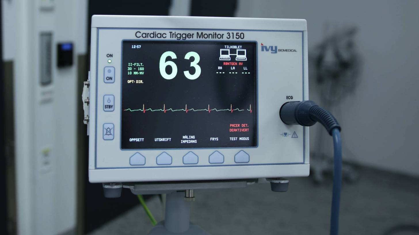 ekg equipment in a hospotal