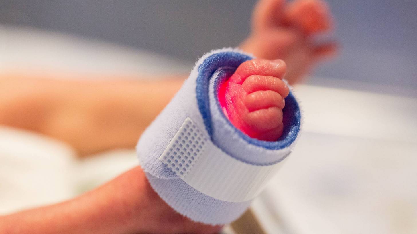 preemies foot being monitored in the hospital