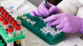 medical worker with blood samples