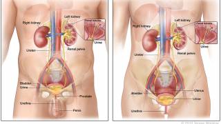 BCG vaccine cancer